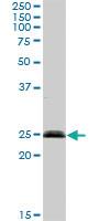 Anti-SENP8 Rabbit Polyclonal Antibody