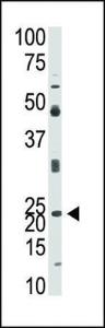 Anti-NEUROG1 Rabbit Polyclonal Antibody (Biotin)