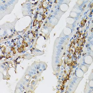 Immunohistochemistry analysis of paraffin-embedded rat intestine using Anti-c-Kit Antibody (A8390) at a dilution of 1:100 (40x lens). Perform high pressure antigen retrieval with 10 mM citrate buffer pH 6.0 before commencing with IHC staining protocol.