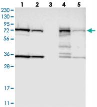 Anti-HSD17B4 Rabbit Polyclonal Antibody