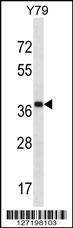 Anti-CLIP4 Rabbit Polyclonal Antibody (FITC (Fluorescein Isothiocyanate))