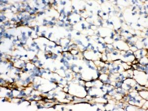 Anti-VCAN Rabbit Polyclonal Antibody