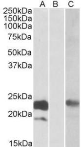 HEK293 lysate (10ug protein in RIPA buffer) overexpressing Human CST8 (RC210130) with C-terminal MYC tag probed