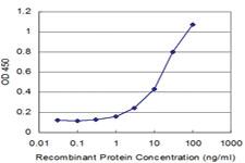 Anti-TPO Mouse Monoclonal Antibody [clone: 2A11]