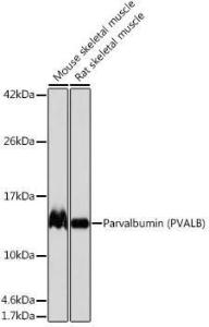 Western blot analysis of extracts of various cell lines, using Anti-Parvalbumin Antibody [ARC0385] (A307807) at 1:1000 dilution