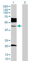 Anti-UBE2Q2 Rabbit Polyclonal Antibody