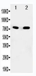 Anti-SDHA Rabbit Polyclonal Antibody