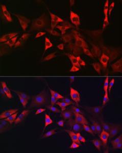 Immunofluorescence analysis of NIH/3T3 cells using Anti-c-Kit Antibody (A8390) at a dilution of 1:50. DAPI was used to stain the cell nuclei (blue).