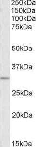 Anti-MAPRE3 antibody