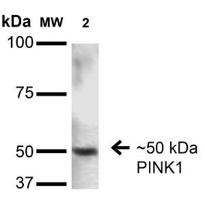 Western blot analysis of rat brain showing detection of ~50 kDa PINK1 protein using Anti-PINK1 Antibody [S4-15] (A305003) at 1:200 for 16 hours at 4°