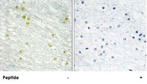 Anti-MED14 Rabbit Polyclonal Antibody