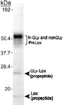 Anti-LOX Rabbit Polyclonal Antibody