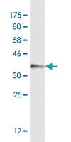 Anti-ATP2B4 Mouse Monoclonal Antibody [clone: 2C7]