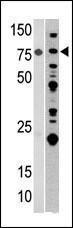 Anti-ACO2 Rabbit Polyclonal Antibody