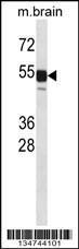 Anti-CLK1 Rabbit Polyclonal Antibody (AP (Alkaline Phosphatase))