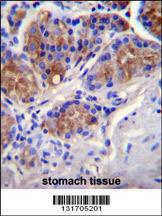 Anti-CASP12 Rabbit Polyclonal Antibody (FITC (Fluorescein Isothiocyanate))