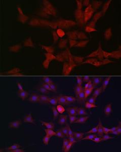 Immunofluorescence analysis of PC-12 cells using Anti-c-Kit Antibody (A8390) at a dilution of 1:50. DAPI was used to stain the cell nuclei (blue).