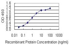 Anti-SYT13 Mouse Monoclonal Antibody [clone: 1H3]