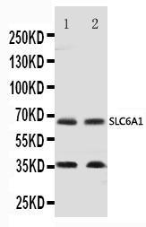 Anti-GAT1 Rabbit Polyclonal Antibody