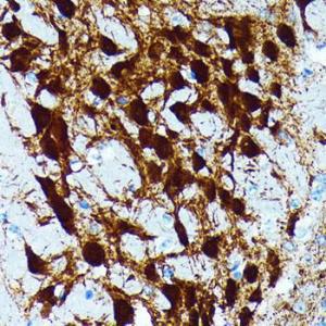 Immunohistochemistry analysis of paraffin-embedded mouse brain using Anti-Parvalbumin Antibody [ARC0385] (A307807) at a dilution of 1:100 (40x lens). Perform microwave antigen retrieval with 10 mM PBS buffer pH 7.2 before commencing with IHC staining protocol