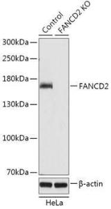 Western blot analysis of extracts from normal (control) and FANCD2 knockout (KO) HeLa cells, using Anti-FANCD2 Antibody (A92841) at 1:1000 dilution. The secondary Antibody was Goat Anti-Rabbit IgG H&L Antibody (HRP) at 1:10000 dilution.