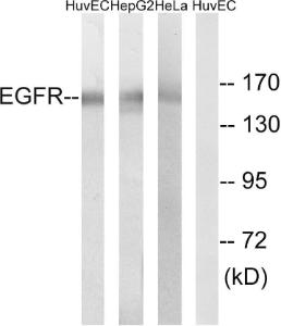 Western blot analysis of lysates from HUVEC, HepG and HeLa cells using Anti-EGFR Antibody. The right hand lane represents a negative control, where the antibody is blocked by the immunising peptide.