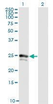 Anti-FGF21 Mouse Monoclonal Antibody [clone: 1A8]