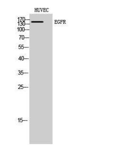 Western blot analysis of HUVEC cells using Anti-EGFR Antibody