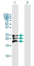 Anti-BST2 Mouse Polyclonal Antibody