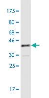 Anti-ATP2B4 Mouse Monoclonal Antibody [clone: 2G8]