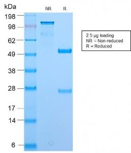 SDS-PAGE analysis of Anti-BrdU Antibody [BRD2888R] under non-reduced and reduced conditions; showing intact IgG and intact heavy and light chains, respectively. SDS-PAGE analysis confirms the integrity and purity of the antibody