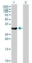 Anti-TYMS Mouse Polyclonal Antibody