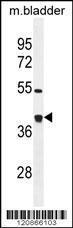 Anti-GLRX3 Rabbit Polyclonal Antibody (AP (Alkaline Phosphatase))