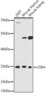 Western blot analysis of extracts of various cell lines, using Anti-Cdk4 Antibody (A309050) at 1:1,000 dilution. The secondary antibody was Goat Anti-Rabbit IgG H&L Antibody (HRP) at 1:10,000 dilution.