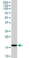 Anti-ALOX5AP Goat Polyclonal Antibody