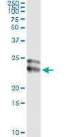 Anti-FGF21 Mouse Monoclonal Antibody [clone: 1A8]