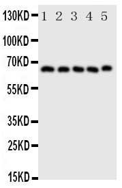 Anti-COX2/Cyclooxygenase 2 Rabbit Polyclonal Antibody