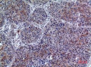 Immunohistochemical analysis of paraffin-embedded human lung using Anti-LILRA1 Antibody