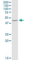 Anti-ADA Rabbit Polyclonal Antibody