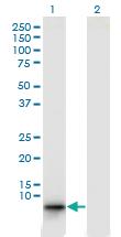 Anti-EBF4 Mouse Monoclonal Antibody [clone: 4E10]