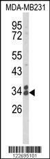 Anti-CLTA Rabbit Polyclonal Antibody (APC (Allophycocyanin))