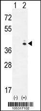 Anti-GALK1 Rabbit Polyclonal Antibody (APC (Allophycocyanin))