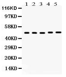 Anti-VDR Rabbit Polyclonal Antibody