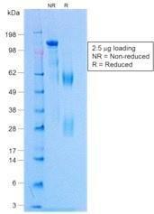 Anti-Rabbit IgG Rabbit Recombinant Antibody [Clone: NCRBM/1520R]