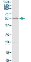 Anti-ADA Rabbit Polyclonal Antibody