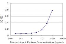 Anti-MEOX2 Mouse Monoclonal Antibody [clone: 5A6]