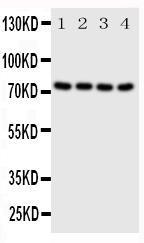 Anti-PAK6 Rabbit Polyclonal Antibody