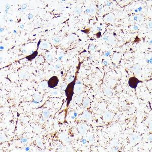 Immunohistochemistry analysis of paraffin-embedded rat brain using Anti-Parvalbumin Antibody [ARC0385] (A307807) at a dilution of 1:100 (40x lens). Perform microwave antigen retrieval with 10 mM PBS buffer pH 7.2 before commencing with IHC staining protocol