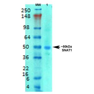 Western blot analysis of rat brain membrane lysate showing detection of SLC38A1 protein using Anti-SLC38A1/NAT2 Antibody [S104-32] (A305004) at 1:1,000