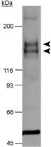 Anti-FLT1 Rabbit Polyclonal Antibody